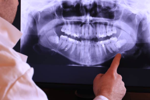 Best Emergency TMJ Treatment in Taylors Falls, MN