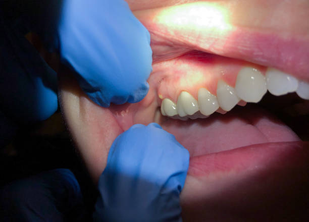 Best Emergency TMJ Treatment in Taylors Falls, MN