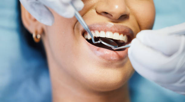 Best Emergency Treatment for Dental Infections or Abscesses in Taylors Falls, MN